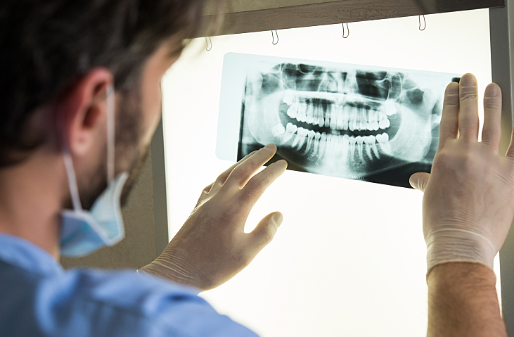 Closeup of dentist looking at dental x-ray plate